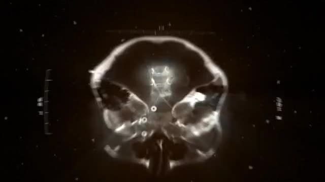 Родовые травмы